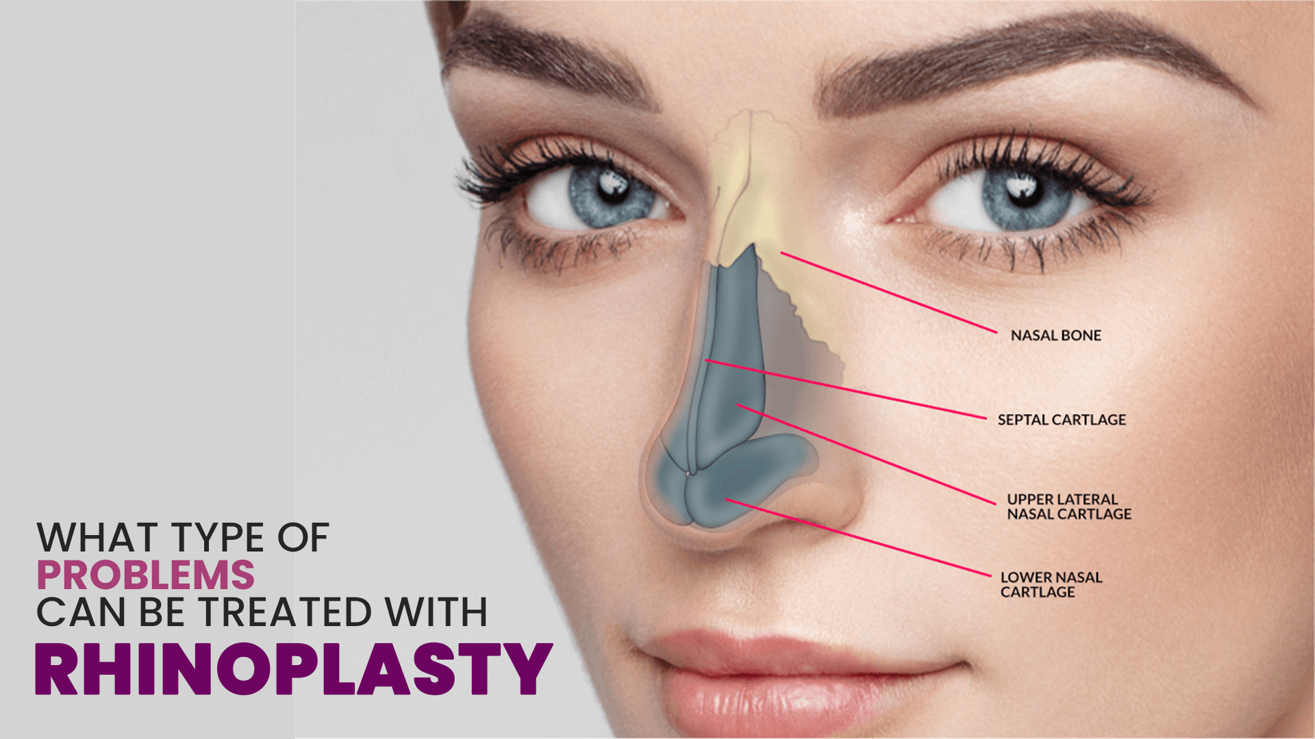 What-type-of-problems-can-be-treated-with-Rhinoplasty